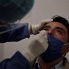 Toman muestra para prueva PCR